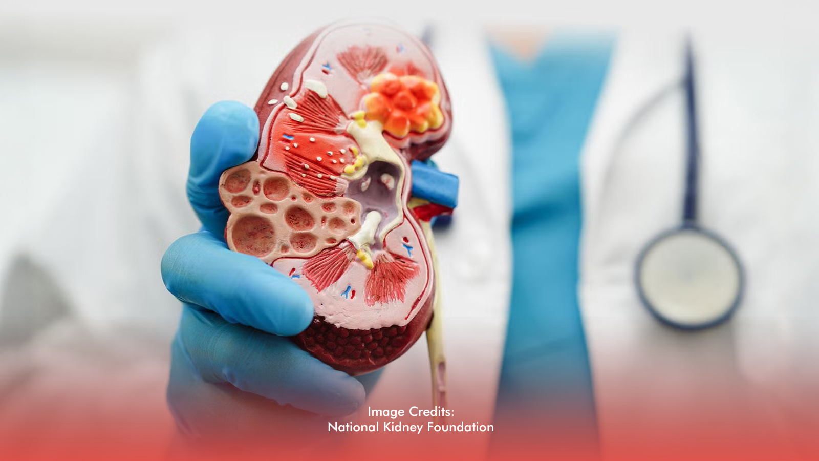 Every 40 Minutes, 1 Filipino Is Diagnosed With CKD: Why Early Screening Matters