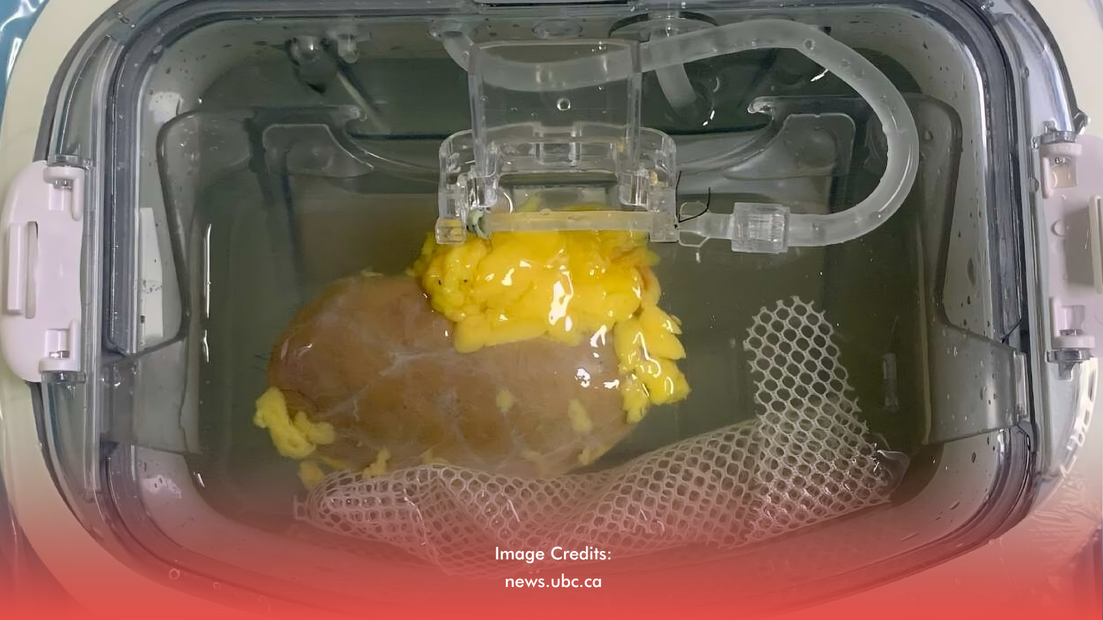 The original experiment involved testing an enzyme-converted kidney into a human model.